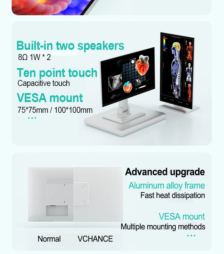VCHANCE 21.5'' Full HD 1080p 100%sRGB Portable Medical Monitor with VESA Mount Display External for Hospital Diagnostic Devices