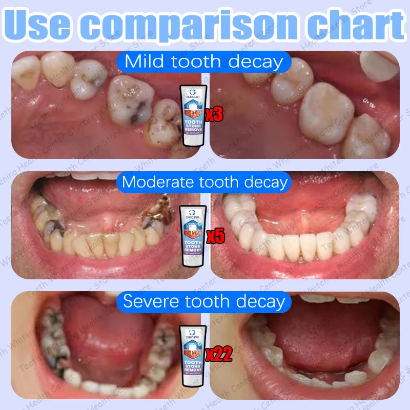 Tooth Decay Repair Treatment | Natural Deep Cleaning & Restorative Formula Scrubs Treatments Tidesmit