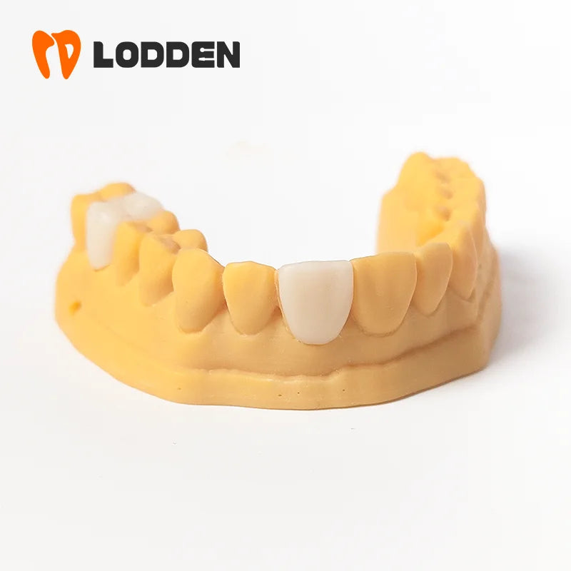 30PCS Lodden Lithium Disilicate C14 Dental Lab Glass-matrix Ceramics Block Chairside Restoration Aesthetics Materials Wholesale