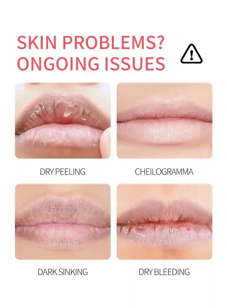 Fruit Lip Balm Set - 8pcs Moisturizing Lip Treatment for Dry Lips Lip Care Tidesmit