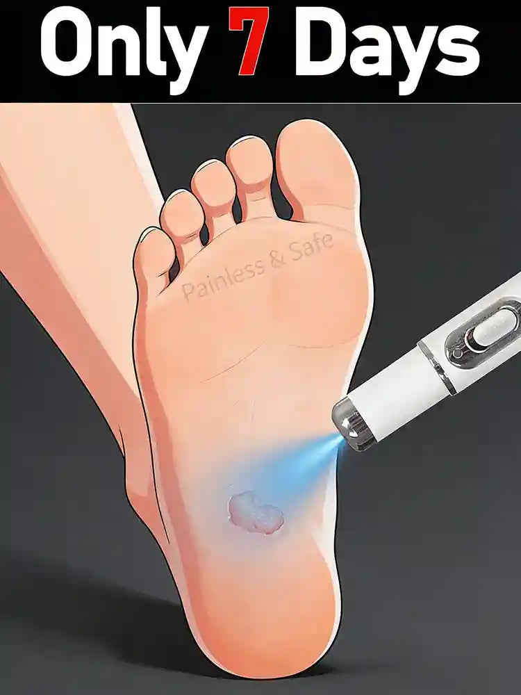 2-in-1 blue light pen treating a foot wart. Portable skin tag and mole remover device for face and body.