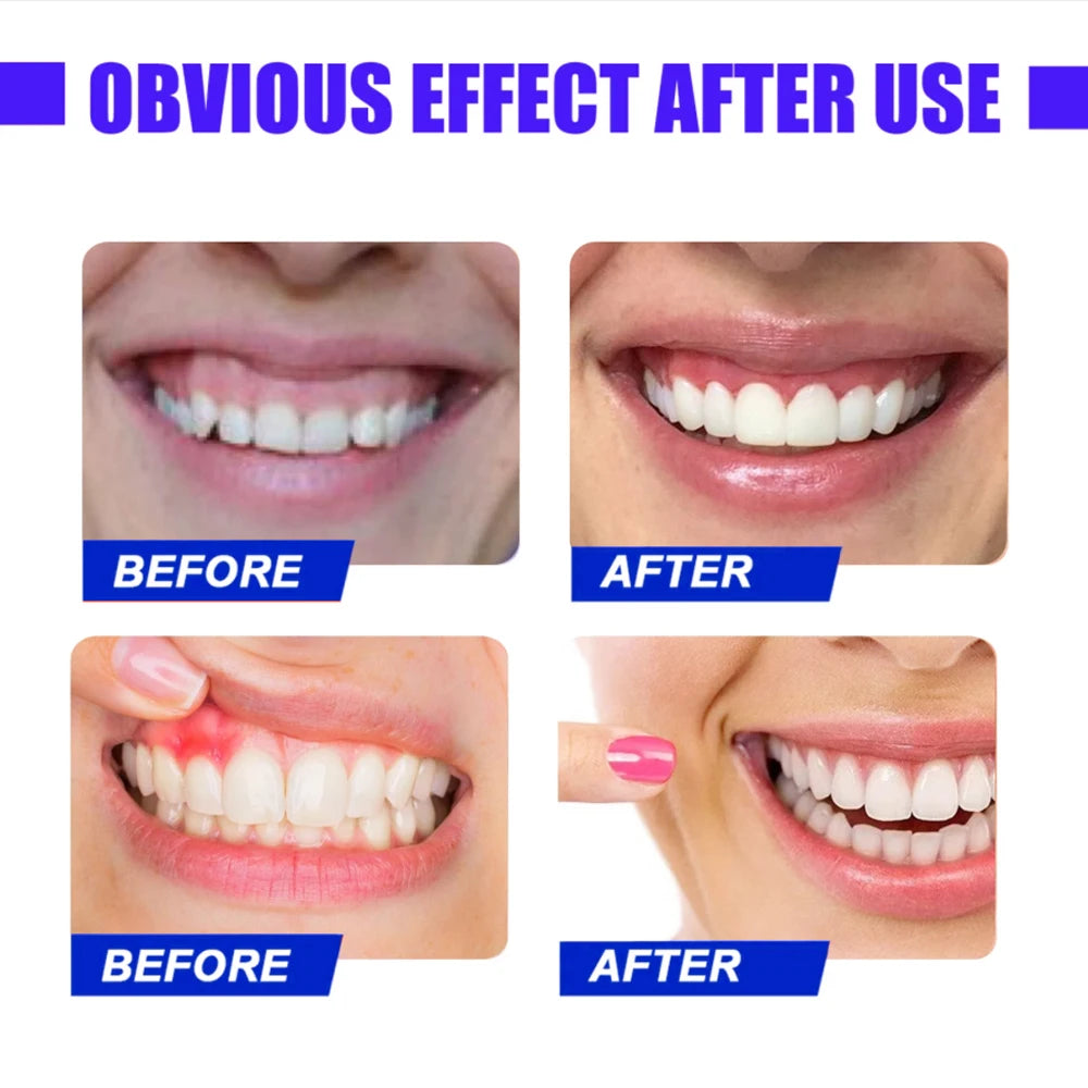 Red Light Therapy for Immediate Relief of Tooth Pain Gum Sensitivity