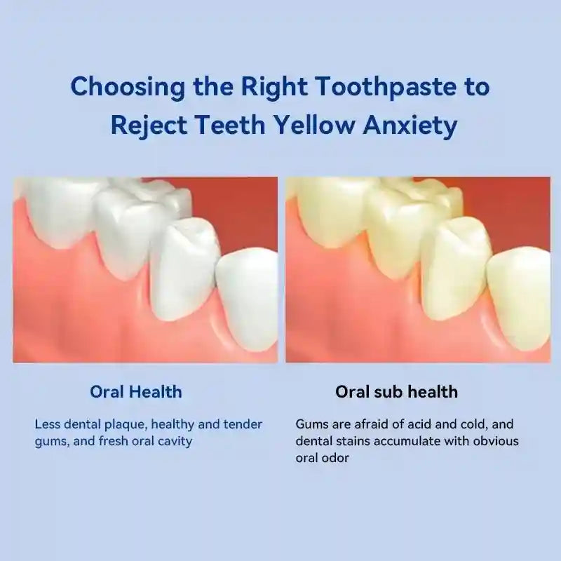 Tidesmit teeth whitening toothpaste for dental calculus removal and periodontitis prevention