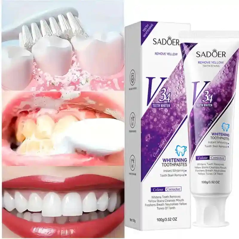 Tidesmit teeth whitening toothpaste for dental calculus removal and periodontitis prevention