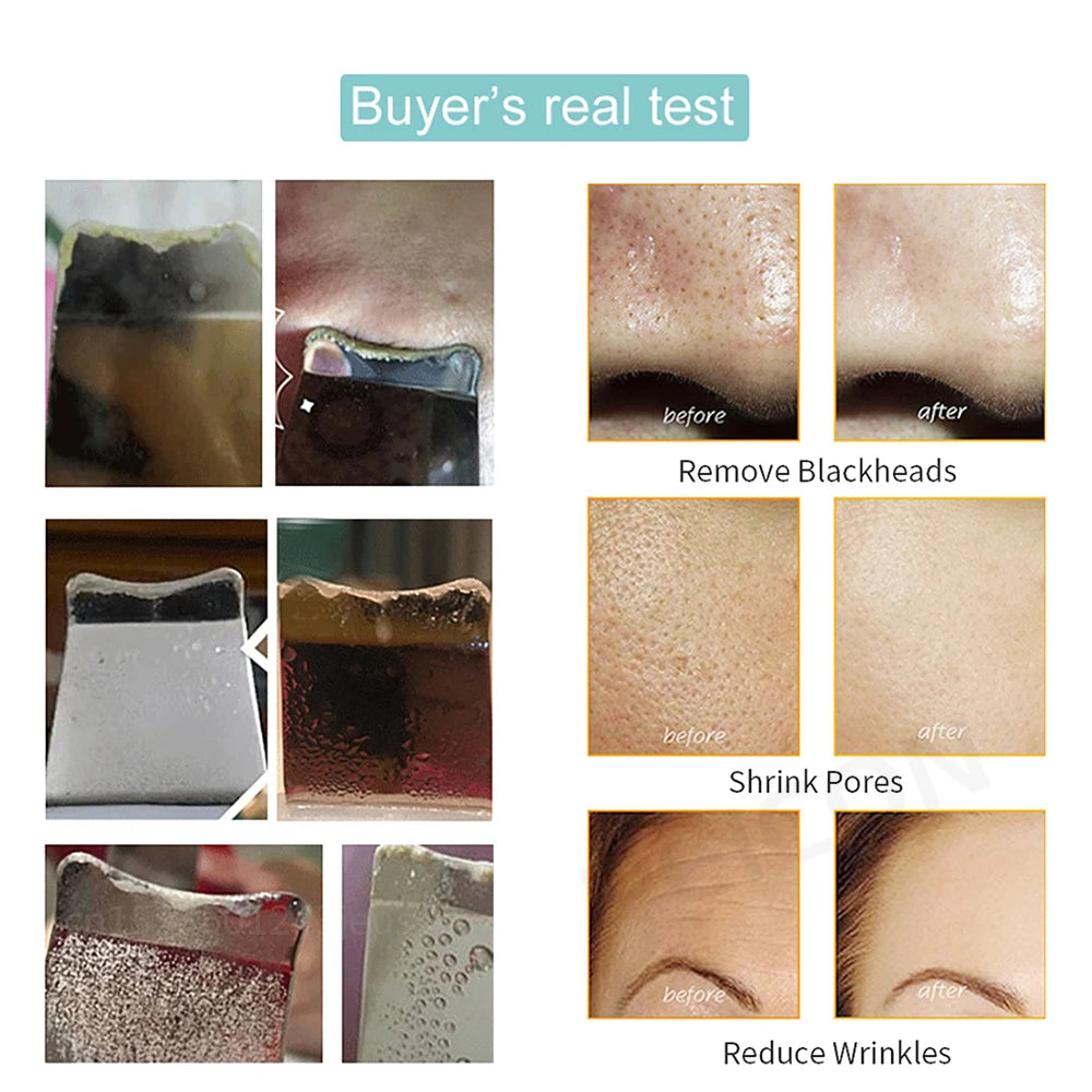Ultrasonic Skin Scrubber | Professional Facial Cleansing Tool Scrubs Treatments Tidesmit