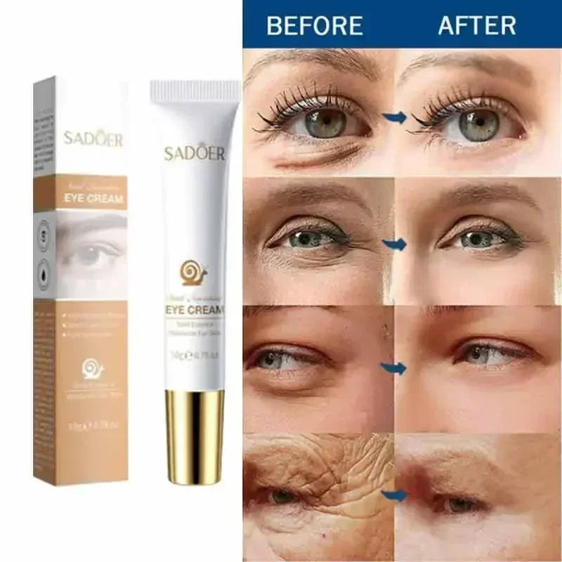 Instant Anti Aging Eye Cream for Dark Circles and Puffiness | Tidesmit Relaxation Treatment Tidesmit