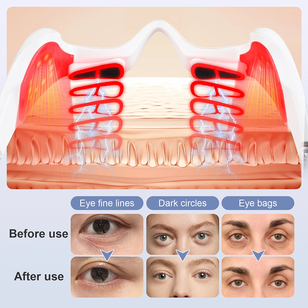 Electric red light eye massager glasses showing anti-wrinkle therapy for dark circles, eye bags, and fine lines.