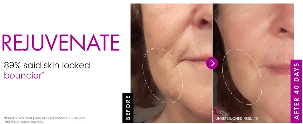Before and after comparison of a face showing reduced fine lines and firmer skin after 40 days of cream use.