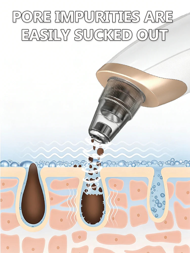 White and gold pore vacuum removing blackheads from a skin cross-section illustration.