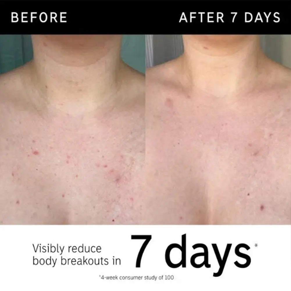 Exfoliating Body Stick Moisturizer - Natural Cruelty-Free Black Formula Scrubs Treatments Tidesmit