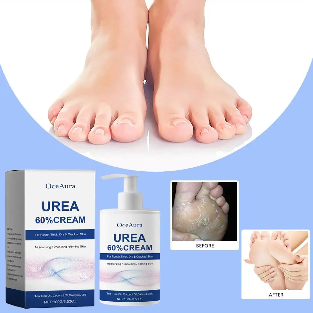 Urea 60% Cream for Cracked Heels - Professional Deep Foot Repair Scrubs Treatments Tidesmit