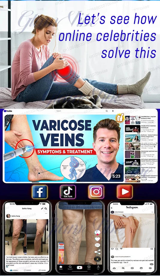 Blue laser therapy pen for treating varicose veins, shown in social media clips targeting leg pain and skin health.
