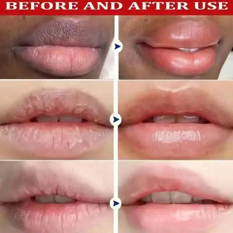 Dark Lip Lightening Balm - Exfoliating Pink Lip Mask by Tidesmit Lip Care Tidesmit