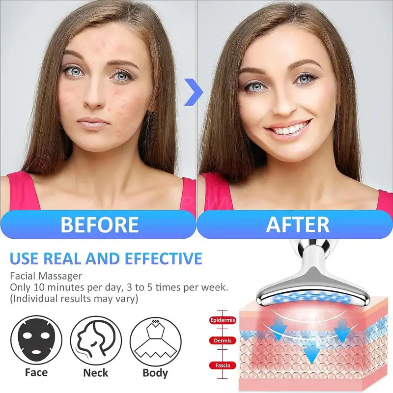 Facial massager with silver T-shaped head and blue light therapy for face, neck, and body skin care.