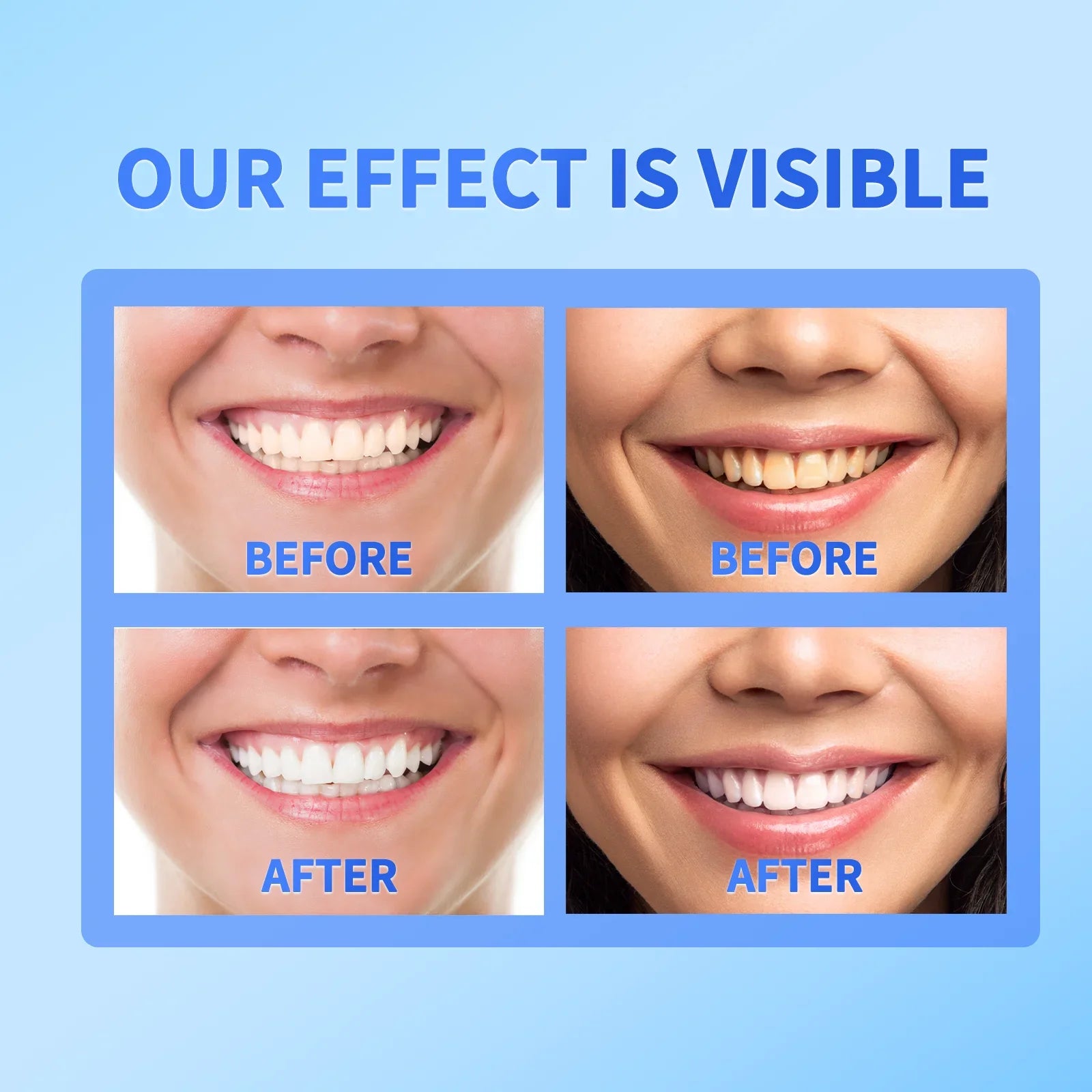Tidesmit SP-6 Probiotic Teeth Whitening Toothpaste for Removing Coffee and Tobacco Stains and Fresh Breath
