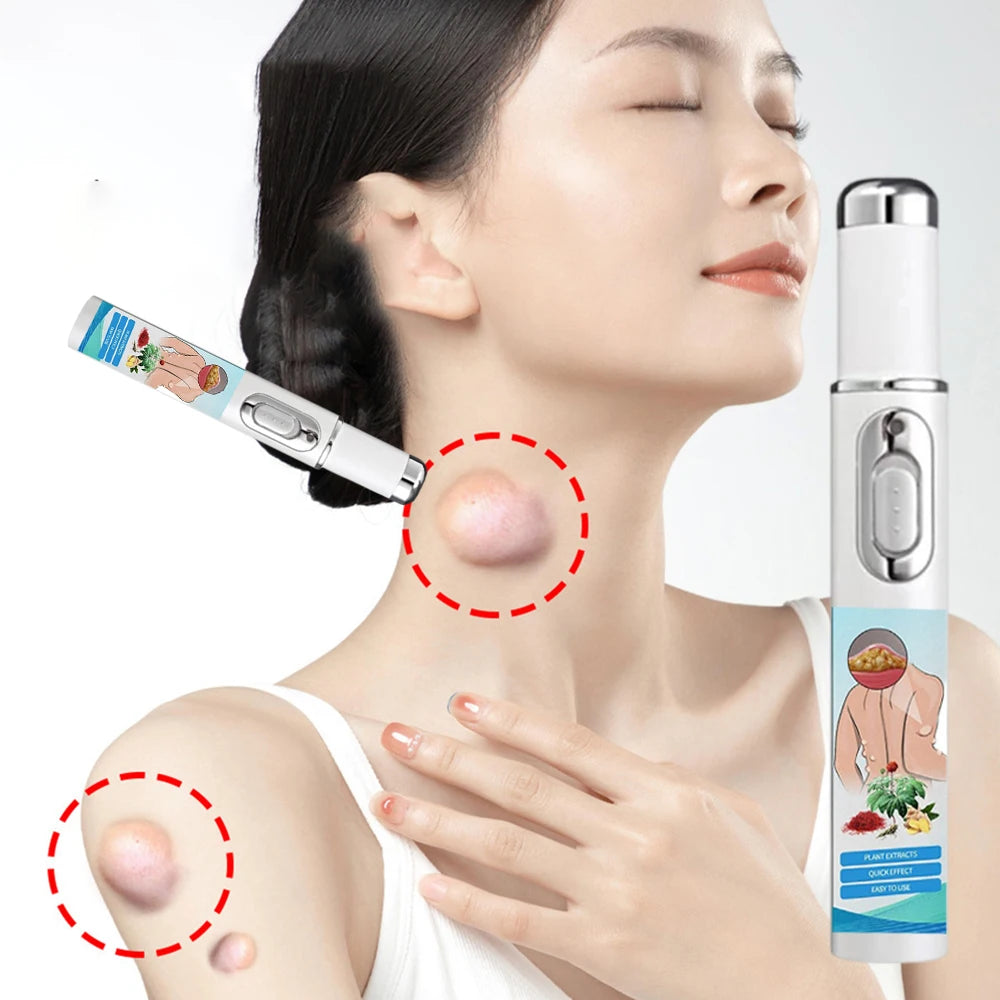 Lipoma Removal Laser Device for Subcutaneous Lumps - Tidesmit Lip Care Tidesmit