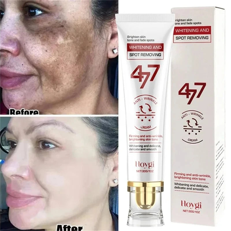 30g whitening and anti-wrinkle cream tube and box, shown with before and after facial skin comparison.