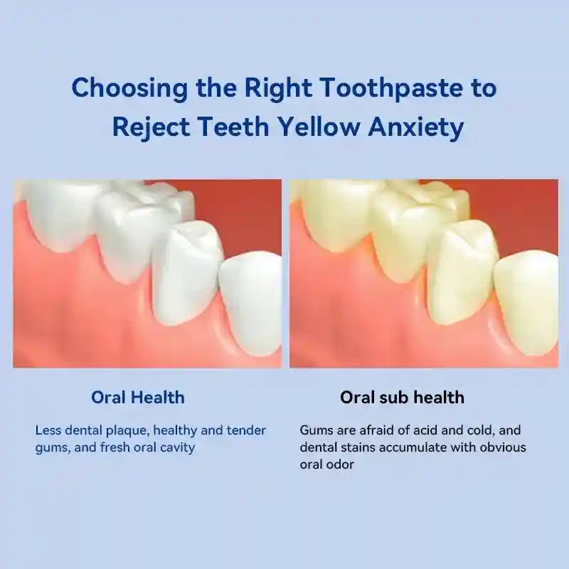 Tidesmit teeth whitening toothpaste for dental calculus removal and fresh breath dental care