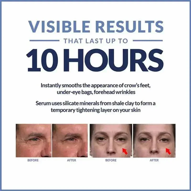 Instant Anti Aging Eye Cream for Dark Circles and Puffiness | Tidesmit Relaxation Treatment Tidesmit