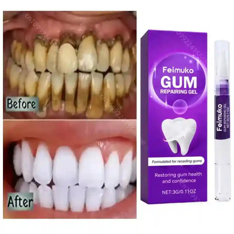 Tidesmit teeth whitening toothpaste and stick kit for professional oral hygiene and fresh breath 2026