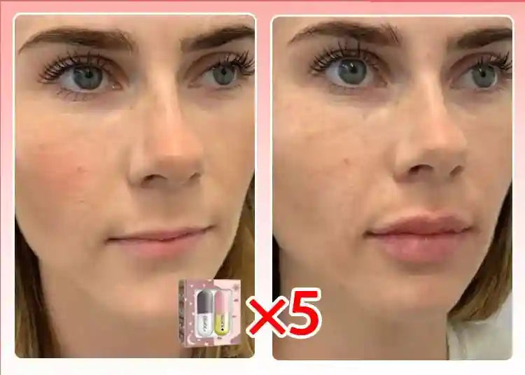 Lip Plumper Gloss Hydrating Serum - Cruelty-Free Volumizing Lip Care Lip Care Tidesmit