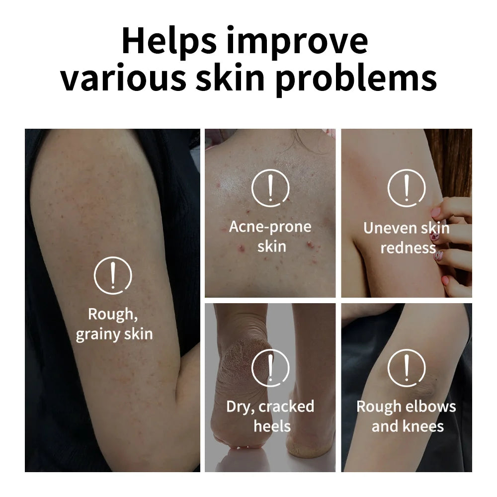 Glycolic Acid Exfoliating Body Stick for Smooth Skin - Tidesmit Scrubs Treatments Tidesmit
