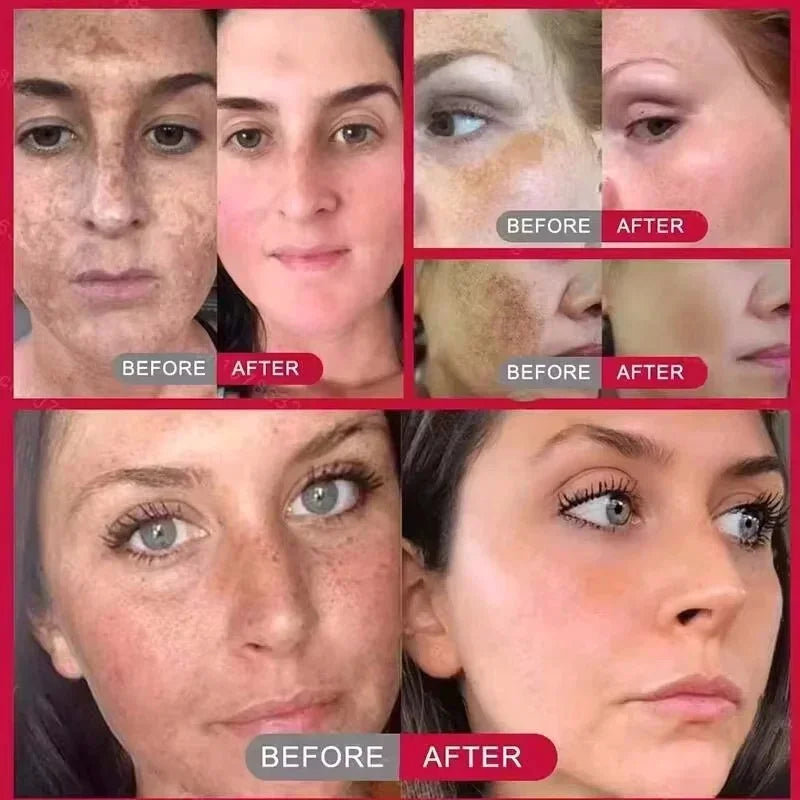 Skin treatment before and after comparisons showing reduced dark spots and improved skin tone for multiple women.
